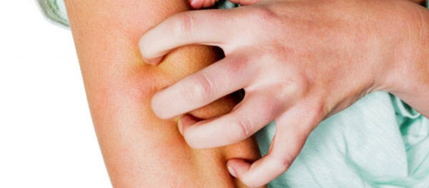 Φαγούρα στο σώμα: Για ποιους λόγους μπορεί να συμβαίνει;